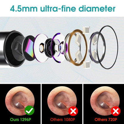 Otoscope auriculaire sans fil - Zevessa