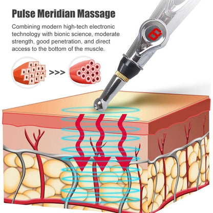 Stylo de massage électrique à points d'acupuncture - Zevessa